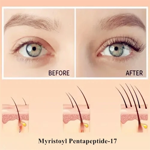 Miristoila pentapeptīds-17: slepenais ierocis skropstu augšanai